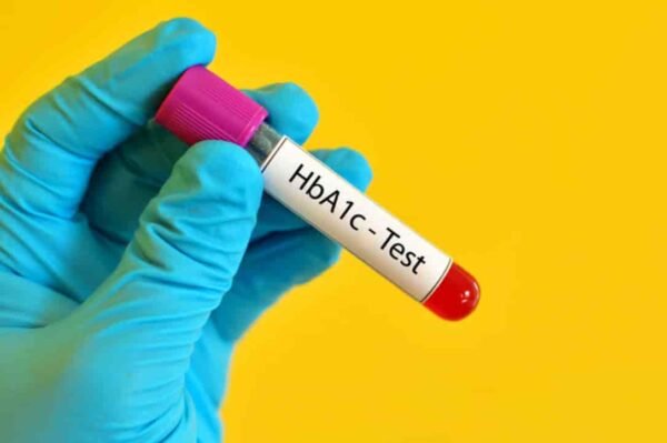 Hemoglobina glucosilada (HbA1c)